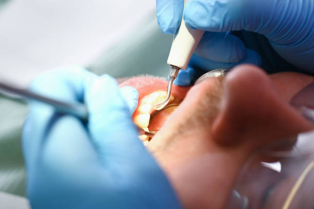 Best Pediatric Emergency Dentist in Arnold, CA