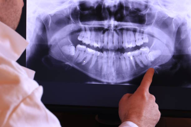 Best Emergency Root Canal Treatment in Arnold, CA