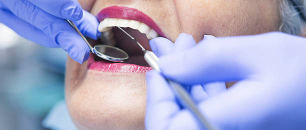 Best Urgent Care for Lost Fillings or Crowns in Arnold, CA